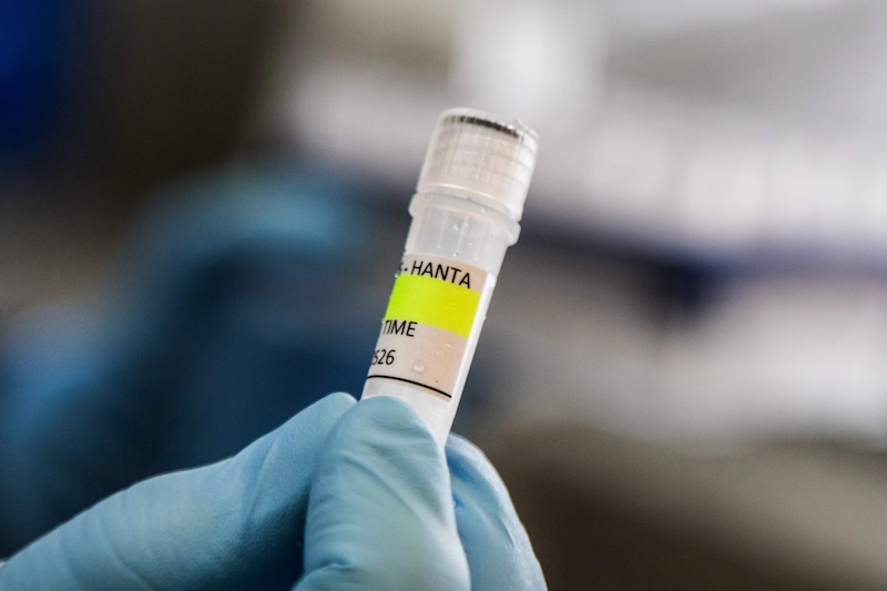 Finland adds Andes virus to dangerous disease list
